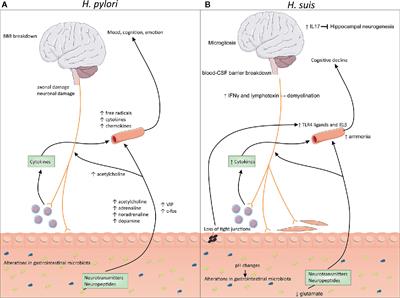 Helicobacter and the Potential Role in Neurological Disorders: There Is More Than Helicobacter pylori